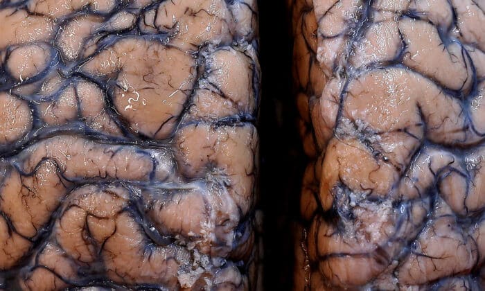 Човешки мозък, част от колекция от над 3000 мозъка в психиатричната болница в Дюфел, Белгия, 19 юли 2017 г. (Ив Херман / Ройтерс)