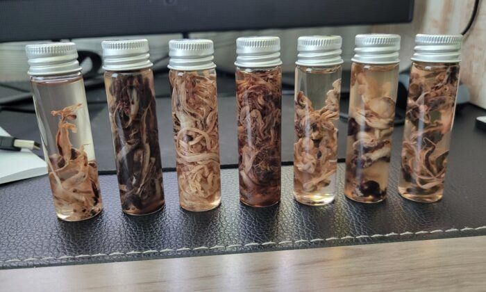 Фиброзни съсиреци, открити в трупове от Ричард Хиршман. (С любезното съдействие на Ричард Хиршман)